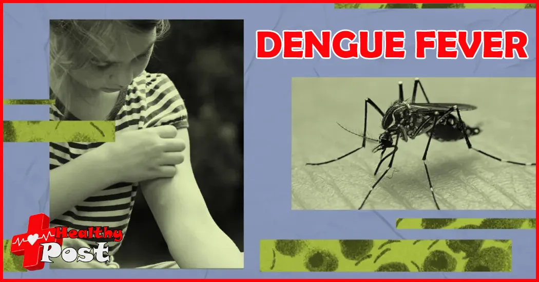 DENGUE FEVER