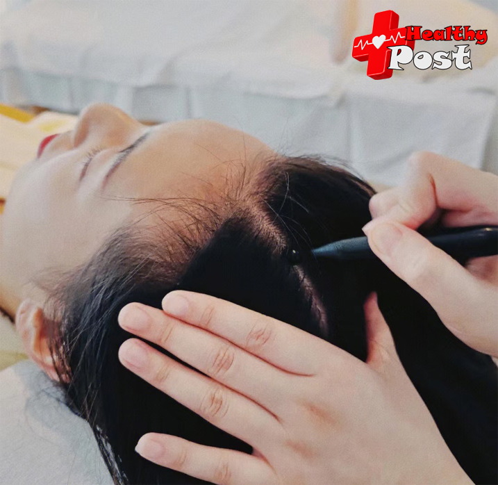 scalp treatment near me