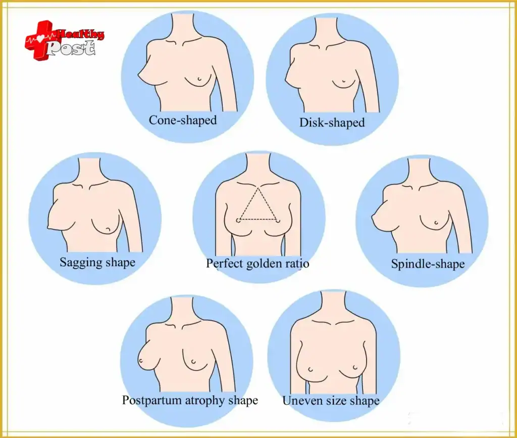 Different breast shapes