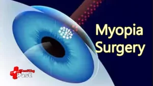 myopia surgery